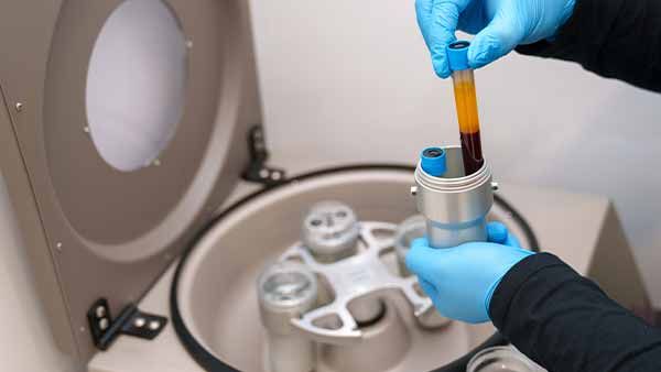 PRP Therapy Why It’s Different