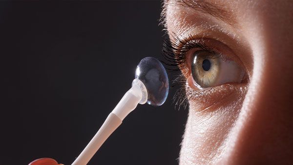 Dry Eye Scleral Lenses