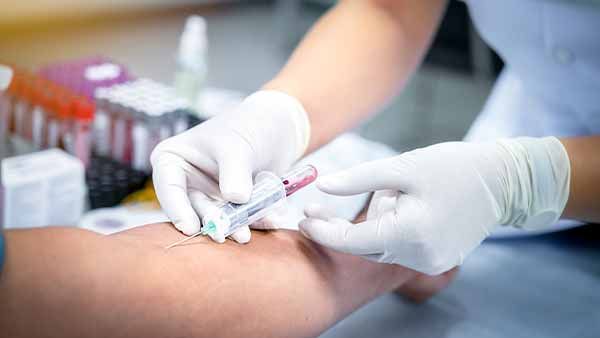 PRP Therapy How It Works